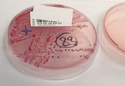 Una muestra de la bacteria 'E.coli' que se analiza en un hospital de Hamburgo