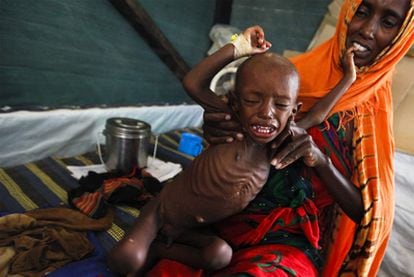 Una mujer somalí sostiene a su hijo en una clínica en el campo de refugiados de Dadaab, al noreste de Kenia.