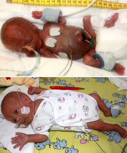 El bebé cuando nació en junio (arriba), y en octubre.