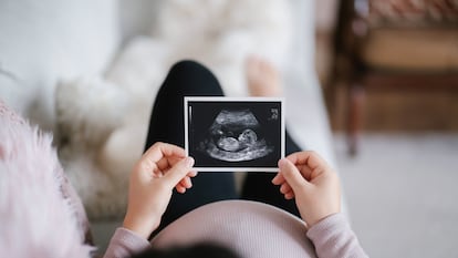 Una mujer sostiene una ecografía.