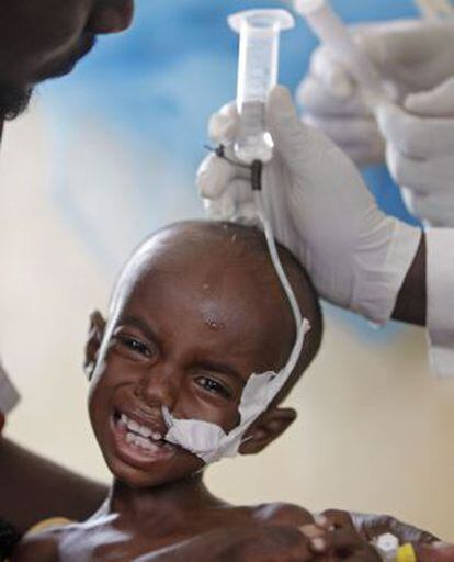 El somalí Adam Ibrahim recibe tratamiento en Kenia. 