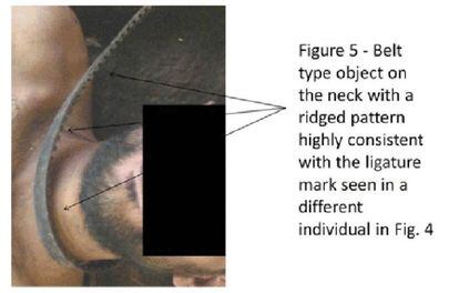Una cinta rodea el cuello de un cadáver. La marca es muy parecida a las encontradas en otros cuerpos.