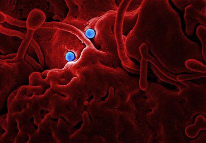 Partículas virales del coronavirus MERS en la superficie de una célula epitelial de camello.