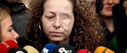 Ester Quintana, 42 años, perdió un ojo el 14-N tras una manifestación.