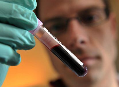 Un técnico de un laboratorio antidopaje, con una muestra de sangre, durante un análisis.