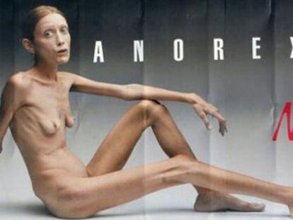 Ha fallecido Isabelle Caro, enferma de anorexia desde los 13 años, quien se dio a conocer en 2007 a través de una campaña publicitaria de la firma de ropa Benetton que pretendía concienciar sobre el horror de esta dolencia.