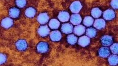 Enterovirus D68.