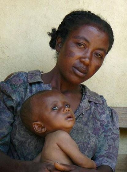Una mujer, con su hijo en una clínica rural cercana a Ambovombe.