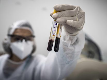 Una profesional de la salud realiza exámenes de sangre a pacientes con coronavirus en el Hospital Municipal de Campaña Gilberto Novaes, construido en Manaos, el 22 de mayo.