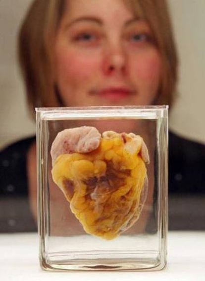 Jennifer Sutton ve su propio corazón en una muestra en Londres.