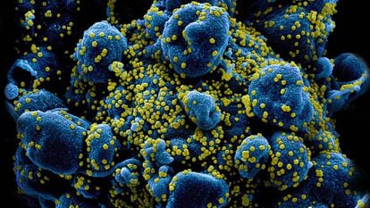 Imagen coloreada de una célula humana (azul) cubierta por virus SARS-CoV-2 (amarillos).