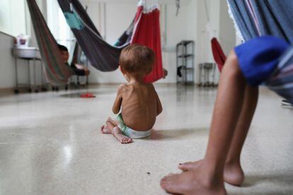 Un infante yanomami que sufre desnutrición dentro del ala dedicada a personas indígenas del hospital pediátrico de Santo Antonio en Boa Vista, capital del Estado de Roraima (Brasil), el pasado 27 de enero.