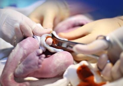 Un médico corta el cordón umbilical de un bebé.