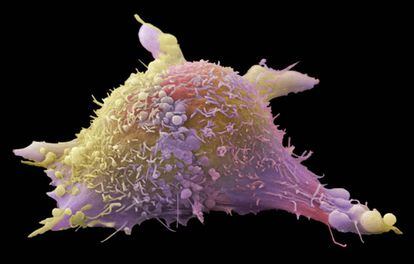 Célula de melanoma como las que se intentan combatir con las nuevas vacunas
