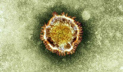 Imagen por microscop&iacute;a electr&oacute;nica de un coronavirus.
