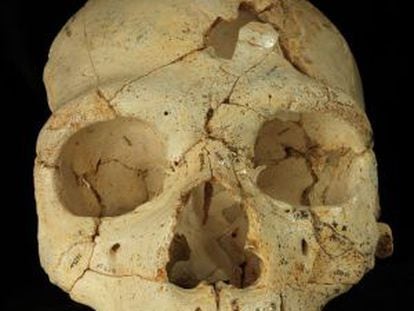 Cráneo 17, de hace 436.000 años, hallado en la Sima de los huesos (Atapuerca, Burgos), con dos perforaciones en la frente posiblemente debidas a una agresión mortal intencionada.