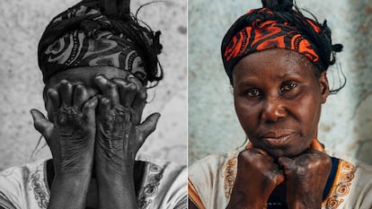 Beatrice N'Guessan rehizo su vida después de padecer lepra de niña. Aún vive con su esposo y varios de sus nueve hijos en la antigua leprosería en la que le trataron la enfermedad hacer medio siglo.