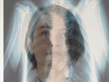 Cáncer de pulmón, la importancia de la detección temprana