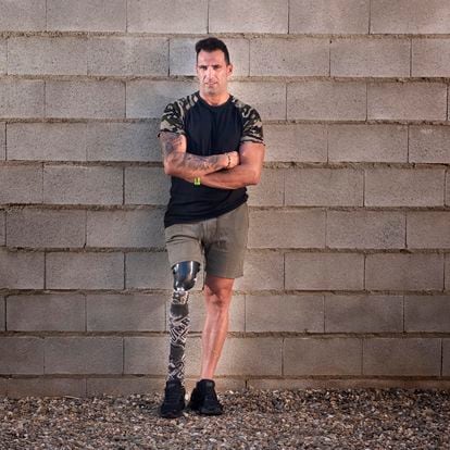 Manuel Rojano, accidentado laboral que perdió una pierna en una descarga de alfalfa.