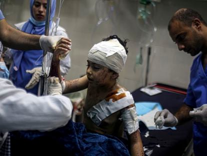 Un niño de 10 años recibe tratamiento médico por las heridas causadas por la ofensiva israelí, este jueves en la localidad de Khan Younis, en el sur de Gaza.