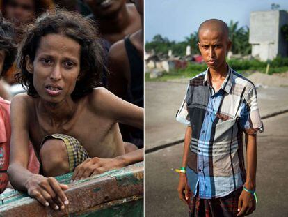 Yusuf, un joven rohingya de 22 años, antes y después de ser rescatado en alta mar y llegar a un campo de refugiados de Aceh (Indonesia).