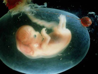 Imagen de un embrión humano, de 7-8 semanas.