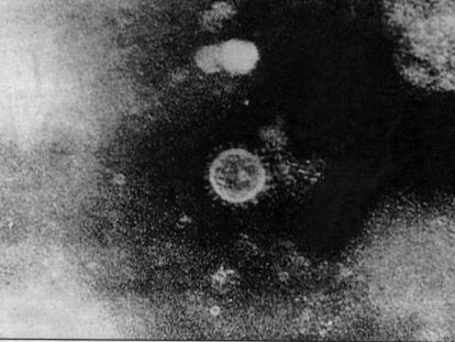 Imagen del virus de la hepatitis C.