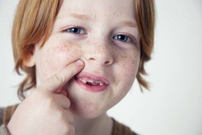 Un niño francés muestra sus dientes de leche.