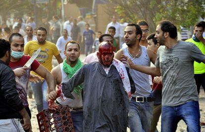 Un hombre herido, partidario del depuesto presidente egipcio Morsi, es evacuado por sus oponenetes, manifestantes que apoyan al ej&eacute;rcito, durante los disturbios de hoy en El Cairo. 