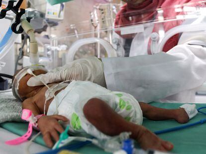 Una médica asiste a un bebé prematuro en el hospital.