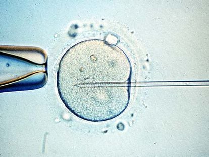 Manipulación con una micropipeta de un óvulo en un proceso de reproducción asistida.