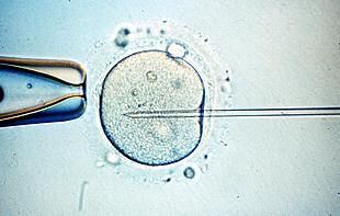 Microinyección de esperma en un óvulo para fecundarlo <i>in vitro.</i>