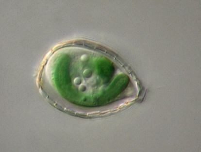 Una ameba del género 'Paulinella' vista al microscopio con sus dos orgánulos fotosintéticos en verde.