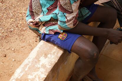 Alassane Dieudonné, uno de los cientos de niños en situación de calle en Burkina Faso, en julio de 2021 en el patio del Centro de Acogida y Urgencia de la Asociación Tié y NouSol ONG, ubicado al sector 15 de la ciudad de Bobo-Dioulasso. Los llamados 'enfants de la rue' (niños de la calle) se suelen tatuar con aceite de anacardo. Dieudonné lleva el número 575 en la pierna.