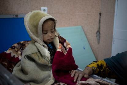 Guldana, de dos años, está desnutrido. Le atienden en el hospital Indira Gandhim en Kabul, Afganistán, el lunes 8 de noviembre de 2021. El número de personas que viven en Afganistán en condiciones cercanas a la hambruna ha aumentado a 8,7 millones, según el Programa Mundial de Alimentos.