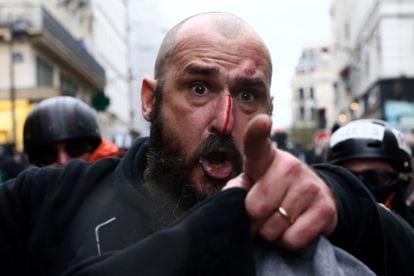 Un hombre herido reacciona la protesta contra la reforma de las pensiones del Gobierno francés, este jueves en París.