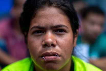 Una migrante con la boca cocida, afuera de la central camionera de Monterrey, en el Estado de Nuevo León, el 15 de junio de 2022.