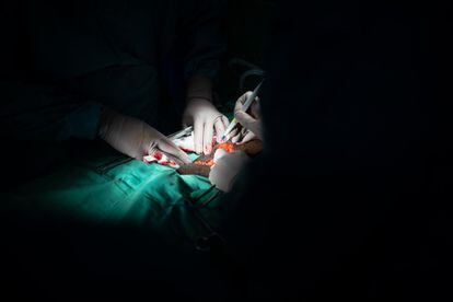 Giménez Bachs, urólogo en el Complejo Hospitalario Universitario de Albacete, sostiene que “la cirugía son pasos reglados”. “Luego hay que tener recursos por si surgen complicaciones”, añade. En el caso de la adenomectomía (extirpar el tumor benigno que crece en la próstata), los cirujanos abren primero las diferentes capas de la piel. “Al final, lo que se busca es aumentar la calidad de vida del paciente. El adenoma obstruye el cuello de la vejiga e impide hacer pis total o parcialmente”, explica el manchego.