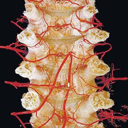 Atlas de anatomía. Las imágenes del cuerpo hechas por David L. Bassett y William Gruber incluyen la médula espinal (en la foto), la mano, el cerebro, las vértebras, los riñones y la cabeza.