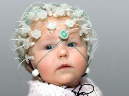 Un beb&eacute; de seis meses con un casco de electrodos para registrar su actividad cerebral.