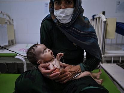 Edi Maa sostiene a su bebé recibiendo tratamiento por desnutrición en un centro de nutrición de Médicos Sin Fronteras (MSF) en Herat (Afganistán) el pasado 22 de noviembre.