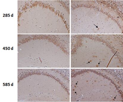 Cerebro normal de ratón, a la izquierda, y cerebro con las placas características del alzhéimer (señaladas con flechas) en distintos periodos (en días) tras la inoculación.
