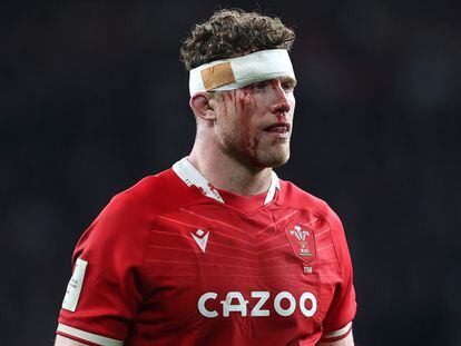 LONDON, ENGLAND - FEBRUARY 26: Only a little blood has been wiped from the face of Will Rowlands of Wales even after the application of a bandage during the Guinness Six Nations Rugby match between England and Wales at Twickenham Stadium on February 26, 2022 in London, United Kingdom. (Photo by Charlotte Wilson/Offside/Offside via Getty Images)