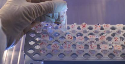 Un investigador se ha sometido al estudio de medicina personalizado más completo jamás realizado