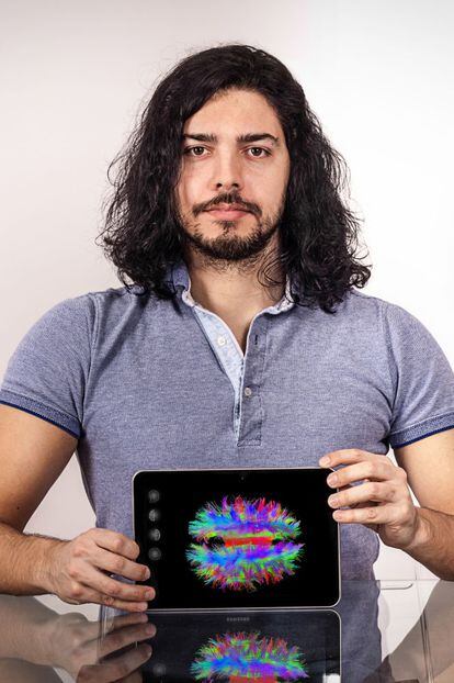 Paulo Rodrigues de Mint Labs que compite en code_n con CloudN, una plataforma de visualización tridimensional de imágenes del cerebro procedentes de resonancias.