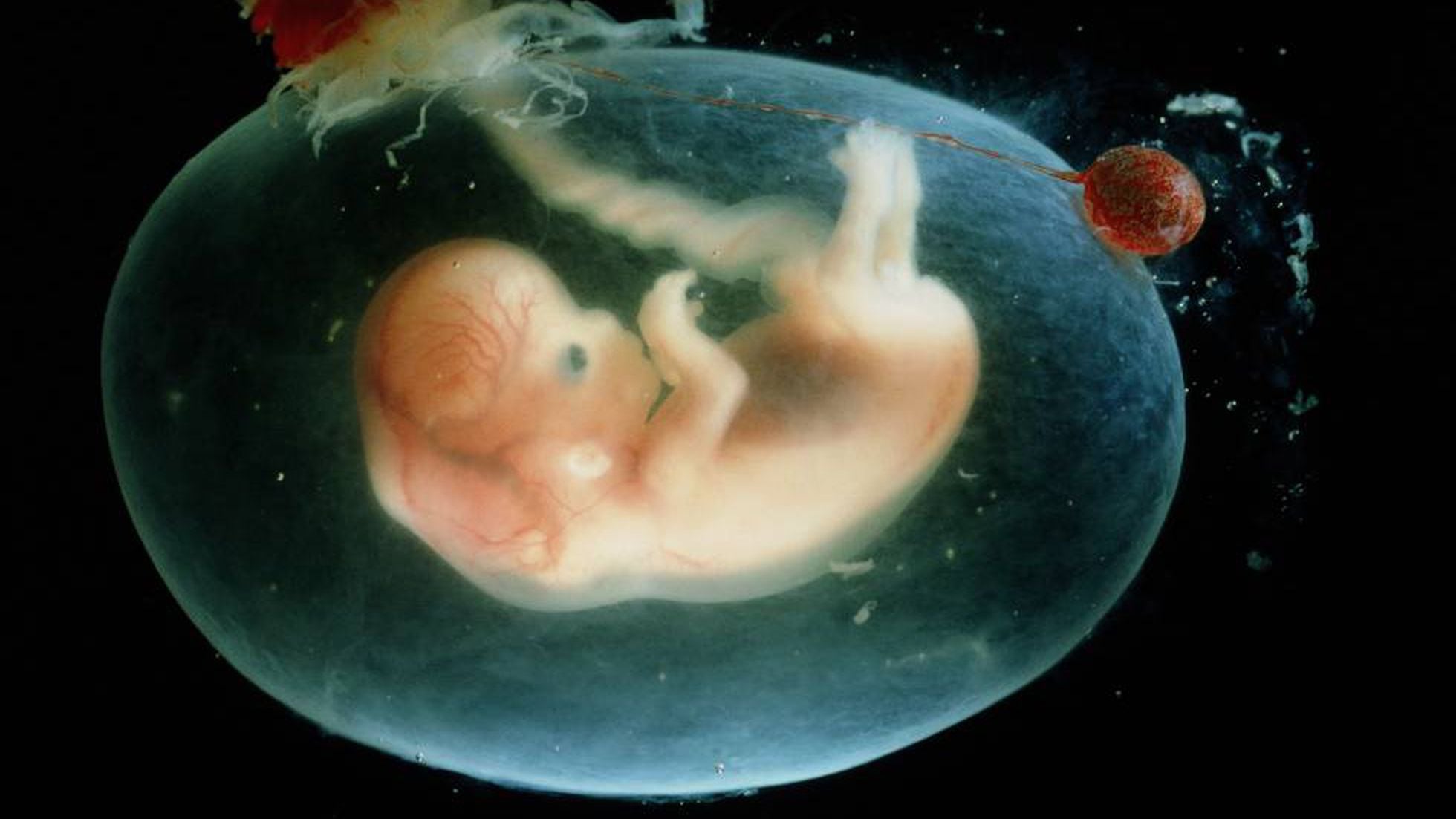Mujer de Estados Unidos da a luz bebé de un embrión congelado hace