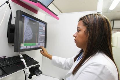 Triple-negative breast cancer affects more women under 40