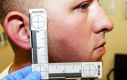 El agente Darren Wilson, con las heridas sufridas supuestamente tras el altercado con Brown.