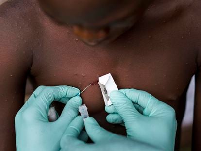 Un equipo del Centro de Control de Enfermedades investiga el virus de la viruela del mono en una aldea del norte de la República del Congo.