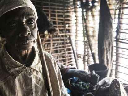 Jetou Mapuani perdió la vista a causa de la oncocercosis y su marido la abandonó.